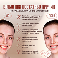 Вакуумний очищувач пор XPREEN 037 Пристрій від чорних точок, алмазний пілінг, вакуумний масаж (XPR-037), фото 7