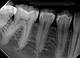 Оренда стоматологічний портативний дентальний рентген апарат BLE рентгенівський апарат для стоматології, фото 2