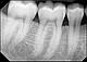 Оренда стоматологічний портативний дентальний рентген апарат BLE рентгенівський апарат для стоматології, фото 4