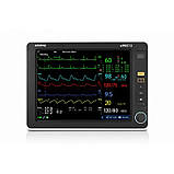 Монітор пацієнта uMEC12 (IMEC12) Медапаратура, фото 3