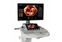 Система ультразвукова діагностична (УЗД) стаціонарна Voluson S8 Touch - фото 3 - id-p2038408400
