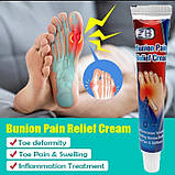 ZB Bunion Pain Relief Знеболювальна мазь для полегшення вальгусного болю в суглобах, від кісточки на нозі., фото 4