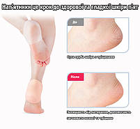 Силіконові підп'ятники від мозолів та тріщин для покращення стану стопи бежеві 21907, фото 5