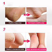 Силіконові підп'ятники від мозолів та тріщин для покращення стану стопи бежеві 21907, фото 8