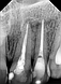 Портативний дентальний рентген апарат REFINE VeRay оригінал для стоматології [версія 2023], фото 8
