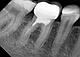Портативний дентальний рентген апарат REFINE VeRay оригінал для стоматології [версія 2023], фото 9
