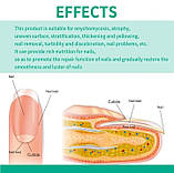 Сироватка для лікування грибка нігтів, фото 5