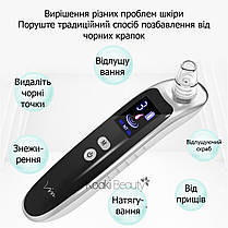 Вакуумний очищувач пор обличчя і шкіри для видалення вугрів, фото 5