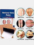 Пластир Varicose Veins Patch, 10 шт., фото 2