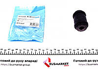 Сайлентблок важеля (заднього/зверху/всередини) Hyundai Santa Fe 01-06 KAVO PARTS SCR-3048 UA61