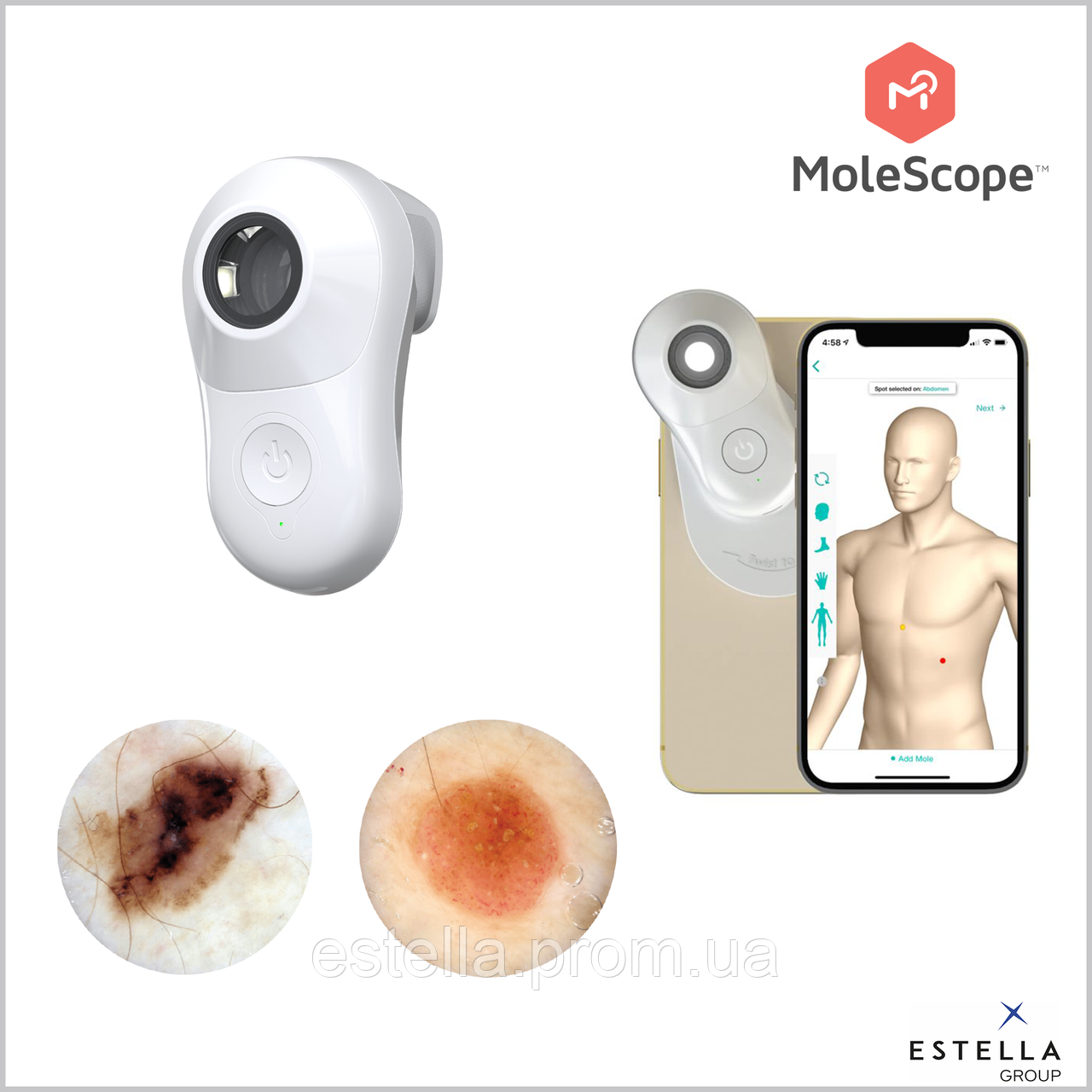 Дерматоскоп цифровий MoleScope II Universal на смартфон / планшет