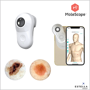 Дерматоскоп цифровий MoleScope II Universal на смартфон / планшет