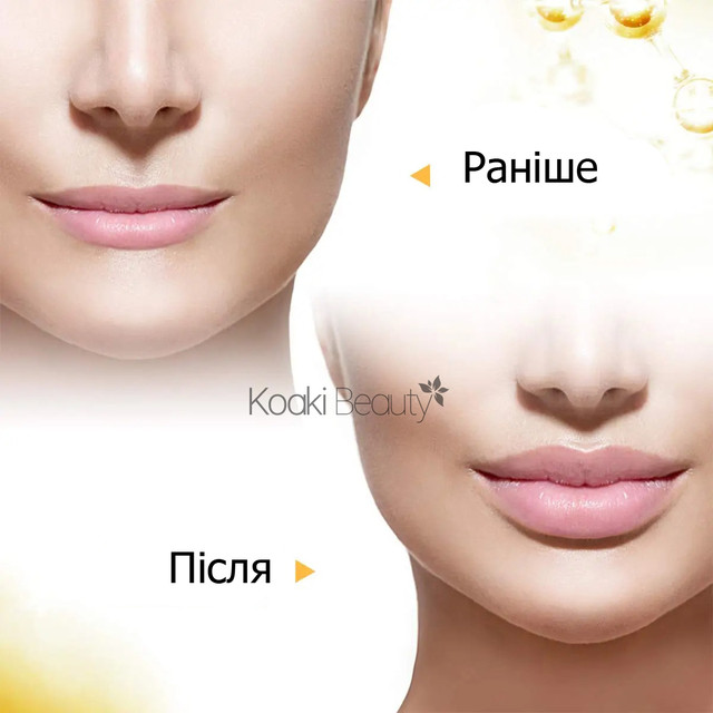ін'єкційна ручка ін'єкційна ручка