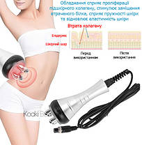 Апарат 3-1 ультразвукової кавітації та RF ліфтингу Smart Bubbles LW-101, фото 2