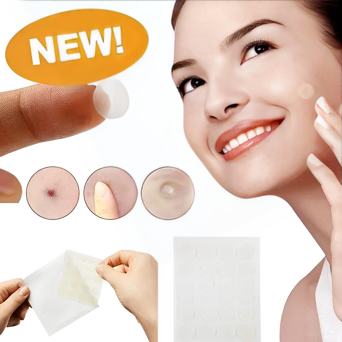 Пластырь от прыщей Acne Patch - фото 1 - id-p2053157665