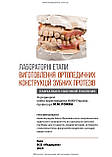 Лабораторні етапи виготовлення ортопедичних конструкцій зубних протезів: навчально-наочний посібник М.М. Рожко, фото 2