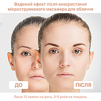 EMS МІКРОТОК MEDICA+ ЛІФТИНГ-МАСАЖЕР для обличчя SKIN LIFTING 6.0 WHITE (ЯПОНІЯ), фото 3