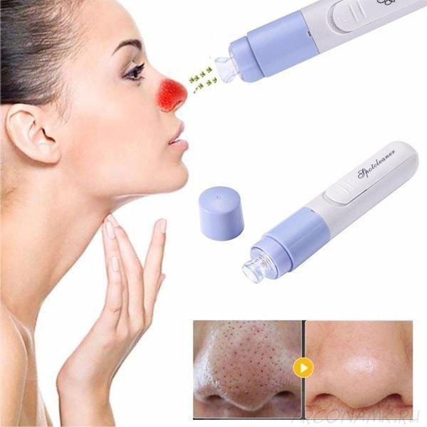 Вакуумний очищувач SPOTCLEANER Face Pore Cleaner вакуумний очищувач TU-437 пор обличчя