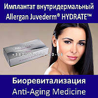 Allergan Juvederm HYDRATE 1 х 1,0 мл Біоревіталізація