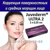 Allergan Juvederm ULTRA 2 — 2x0,55 мл Корекція поверхневих і середніх зморщок обличчя