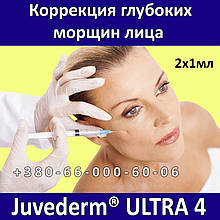 Allergan Juvederm ULTRA 4 - 2 x 1мл Корекція зморшок особи