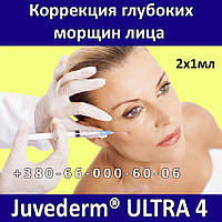 Allergan Juvederm ULTRA 4 - 2 x 1мл Корекція зморшок особи