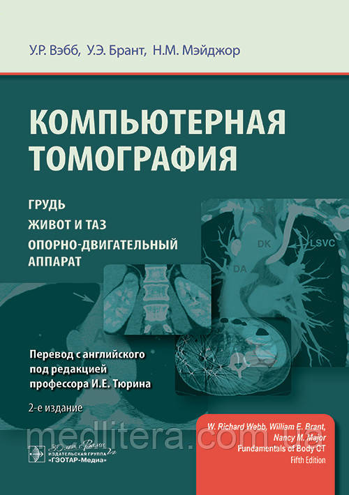 Веб У, Брант, Комп'ютерна томографія. Груди, живіт і таз, опорно-руховий апарат 2-е видання 2023 рік