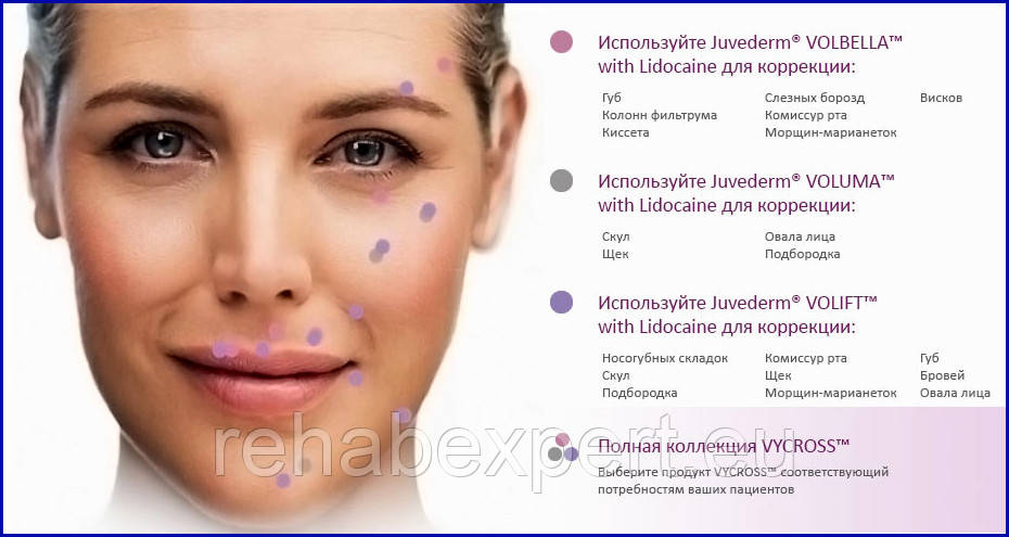 Allergan Juvederm VOLIFT 2 x 1мл Корекція області щік, підборіддя, овалу обличчя і носогубних складок