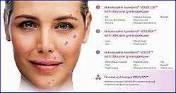 Allergan Juvederm VOLIFT 2 x 1мл Корекція області щік, підборіддя, овалу обличчя і носогубних складок