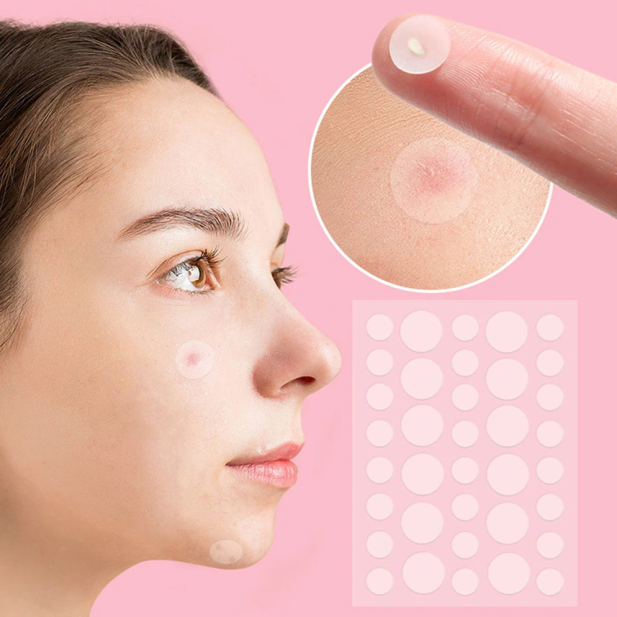 Лечебный пластырь 72шт от папиллом и бородавок Acne Patch, Точечный пластырь-патч от бородавок и прыщей - фото 1 - id-p2064427109