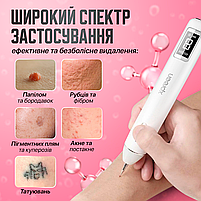 Електрокоагулятор плазмовий прилад для видалення папілом бородавок апарат Plasma Pen (плазмова ручка) XPREEN 061, фото 3