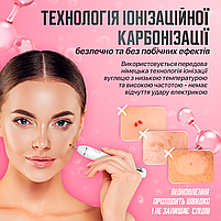 Електрокоагулятор плазмовий прилад для видалення папілом бородавок апарат Plasma Pen (плазмова ручка) XPREEN 061, фото 8