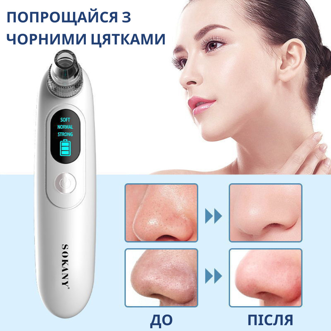 Очищувач вакуумний для пор шкіри обличчя 3 в 1 апарат для чищення чорних точок Sokany SK-319 - фото 5 - id-p2075254246