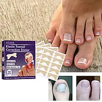 Набір пластирів Elastic Toenail Correction Sticker для безболісної корекції врослих нігтів Jw