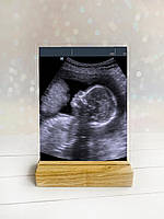 Акриловая фотография УЗИ беременности. УЗИ плода, малыша