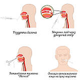 КАТЕТЕР ДЛЯ ЗУПИНКИ НОСОВОЇ КРОВОТЕЧІ (з дистальним балоном), фото 3