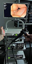 Ендоскопічна стійка OLYMPUS EVIS EXERA III (190), фото 3