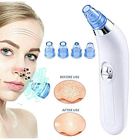 Вакуумный очиститель Derma Vacuum для профессиональной чистки кожи и пор лица - легкий компактный TeraMarket