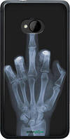 Чохол на HTC One M7 Рука через рентген "1007u-36-63407"
