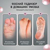 Електрична пемза для ніг, пилка електрична для ніг акумуляторна Машинка для видалення мозолів (CRFF-10), фото 3