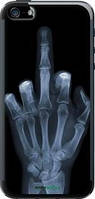 Чехол на iPhone SE Рука через рентген "1007u-214-10746"