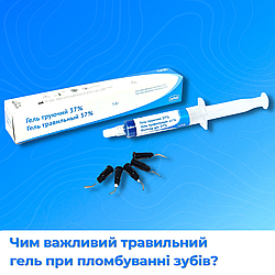 Чому важливо використовувати травильний гель при пломбуванні зубів?