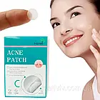 Маска для обличчя із зеленим чаєм + Подарунок Пластир від прищів / Глиняна маска-стік для глибокого очищення шкіри, фото 9