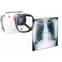 Система медична рентгенографічна цифрова REMEX-KA6