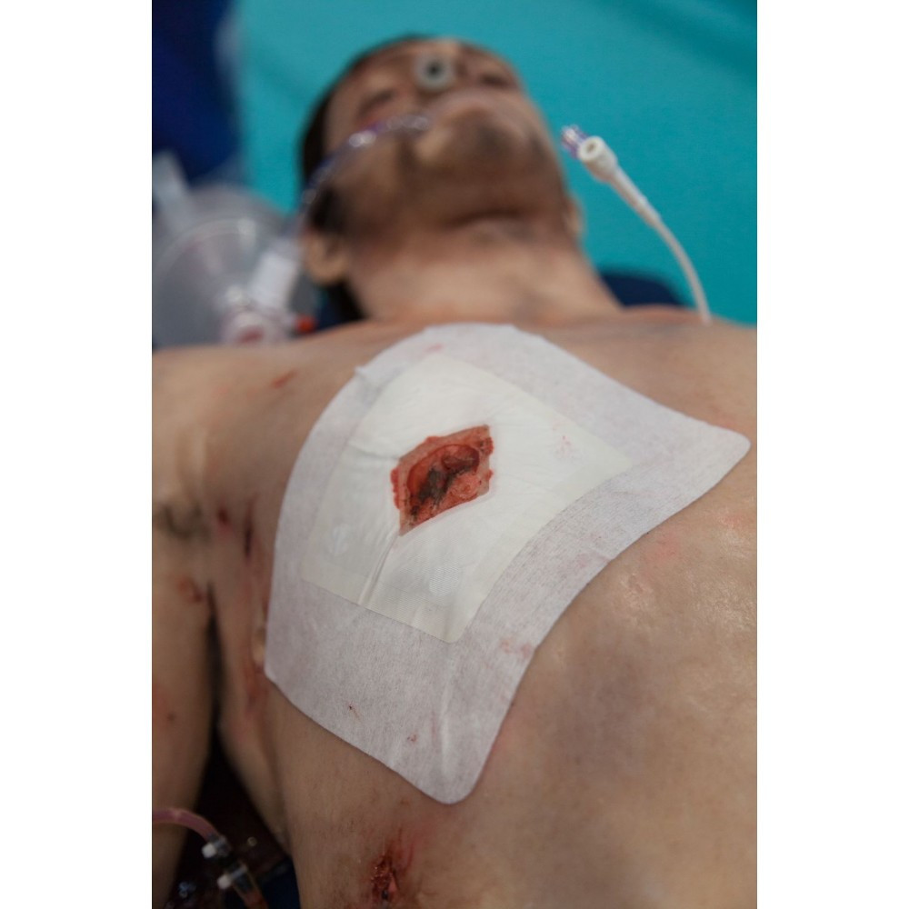 Окклюзионная Повязка Невентилируемая Safeguard Medical Russell Chest Seal Оклюзионная Наклейка - фото 5 - id-p2102509663