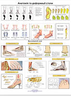 Плакат анатомии и деформации стопы 50 x 64.5 см