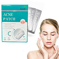 Китайские пластыри 72шт от бородавок и прыщей Acne Patch, Пластырь-патч от акне, прыщей и бородавок TMK