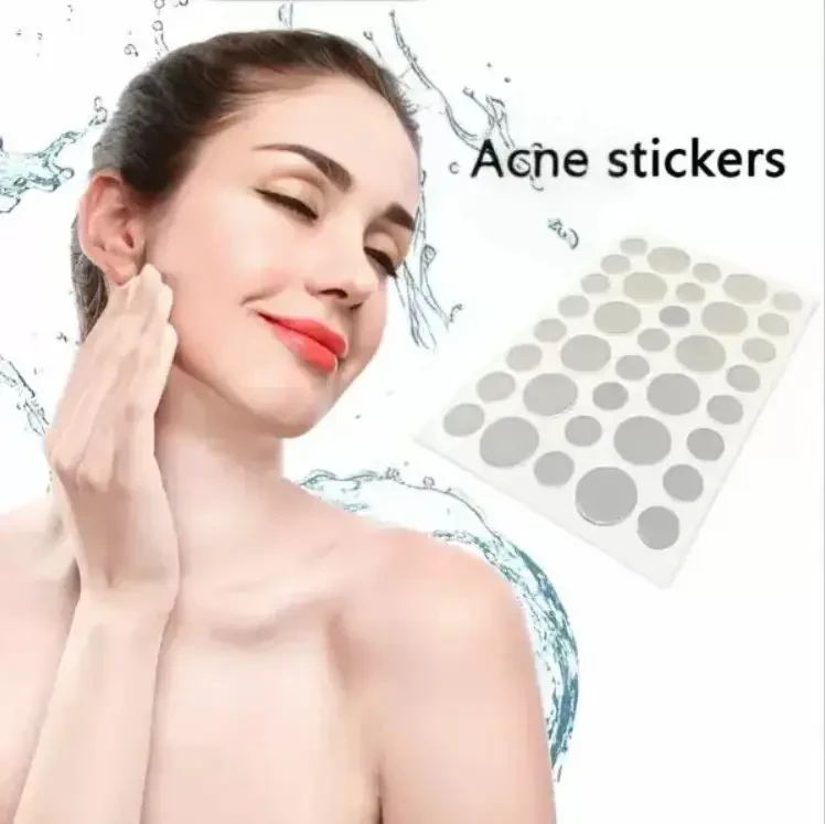 Китайские пластыри 72шт от бородавок и прыщей Acne Patch, Пластырь-патч от акне, прыщей и бородавок TMK - фото 4 - id-p2106778077