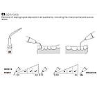 Насадка Woodpecker G3, для скейлінгу, різьба EMS, фото 2