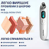 Очищувач вакуумний для пор шкіри обличчя 3 в 1 апарат для чищення чорних точок Sokany SK-319, фото 6